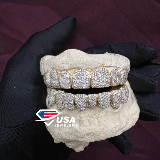 VVS1 Moissanite Diamond 10 Top and 10 Bottom 10KT Gold Grills Set